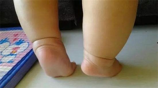 成人脚尖走路视频大全集,揭秘成人脚尖走路技巧与风采展示