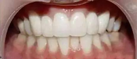 成人牙齿发掘视频大全集,视频大全集深度解析